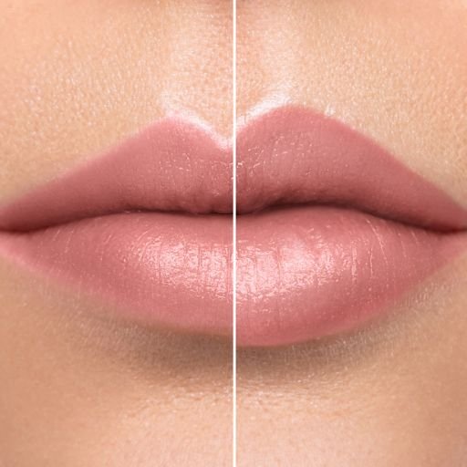 Preenchimento labial: metade esquerda antes, metade direita depois